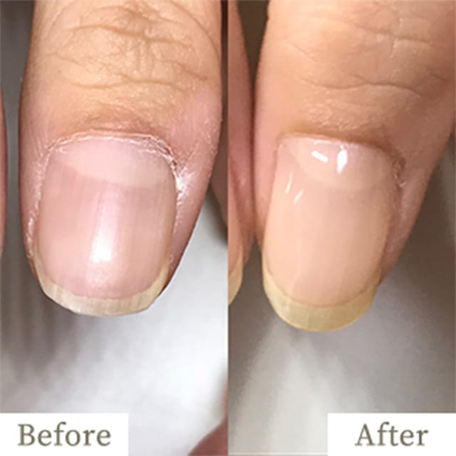 ba-img10 - トレフル|明石の深爪矯正ネイルサロン 明石市の深爪矯正専門サロン|深爪・噛み爪・むしり癖でお悩みならトレフル