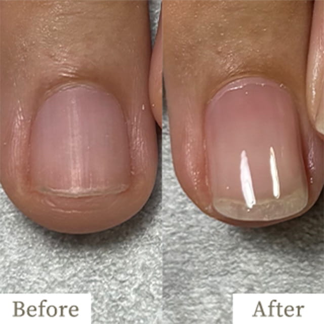 ba-img22 - トレフル|明石の深爪矯正ネイルサロン 明石市の深爪矯正専門サロン|深爪・噛み爪・むしり癖でお悩みならトレフル