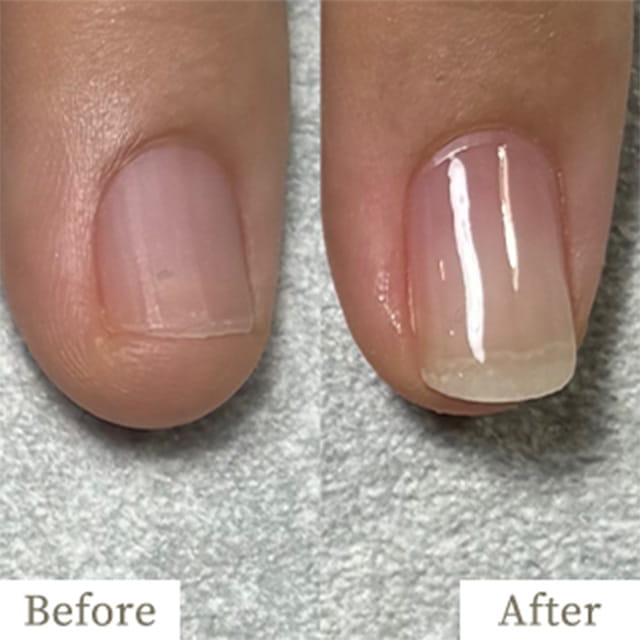 ba-img23 - トレフル|明石の深爪矯正ネイルサロン 明石市の深爪矯正専門サロン|深爪・噛み爪・むしり癖でお悩みならトレフル