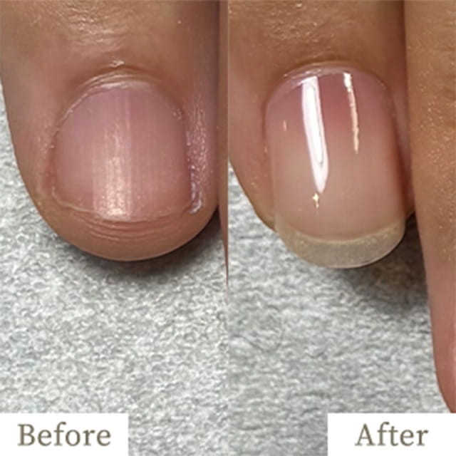 ba-img24 - トレフル|明石の深爪矯正ネイルサロン 明石市の深爪矯正専門サロン|深爪・噛み爪・むしり癖でお悩みならトレフル