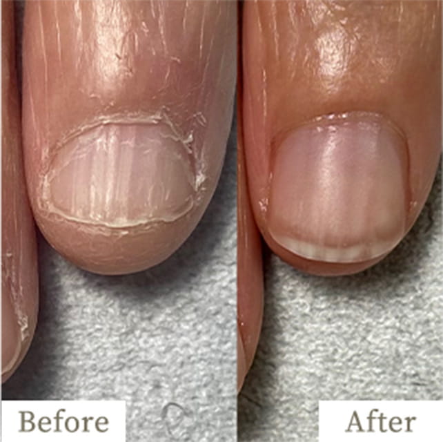 ba-img29 - トレフル|明石の深爪矯正ネイルサロン 明石市の深爪矯正専門サロン|深爪・噛み爪・むしり癖でお悩みならトレフル