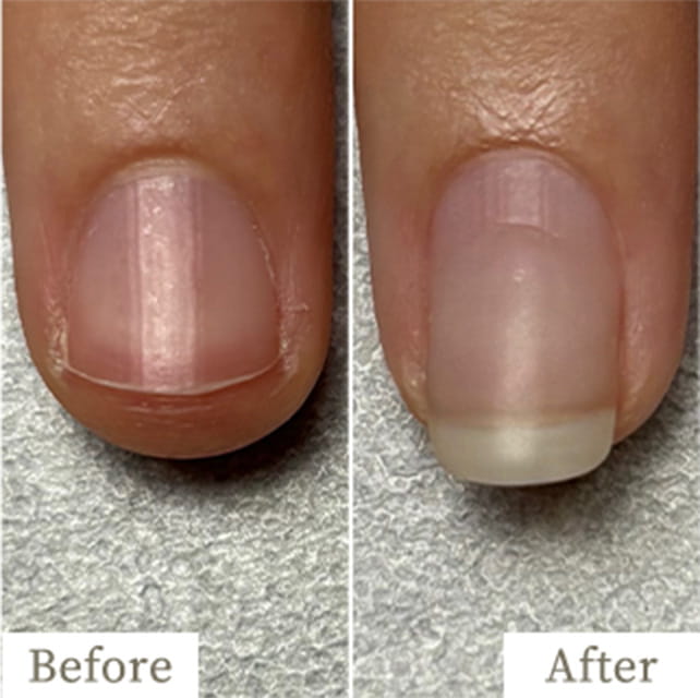 ba-img33 - トレフル|明石の深爪矯正ネイルサロン 明石市の深爪矯正専門サロン|深爪・噛み爪・むしり癖でお悩みならトレフル