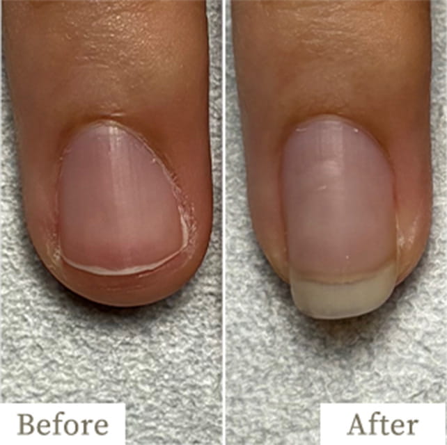 ba-img34 - トレフル|明石の深爪矯正ネイルサロン 明石市の深爪矯正専門サロン|深爪・噛み爪・むしり癖でお悩みならトレフル