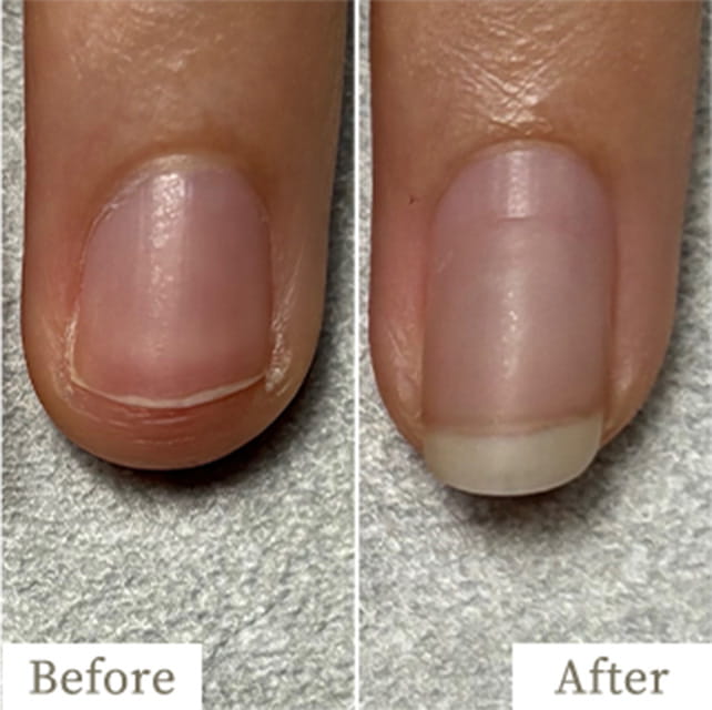 ba-img35 - トレフル|明石の深爪矯正ネイルサロン 明石市の深爪矯正専門サロン|深爪・噛み爪・むしり癖でお悩みならトレフル