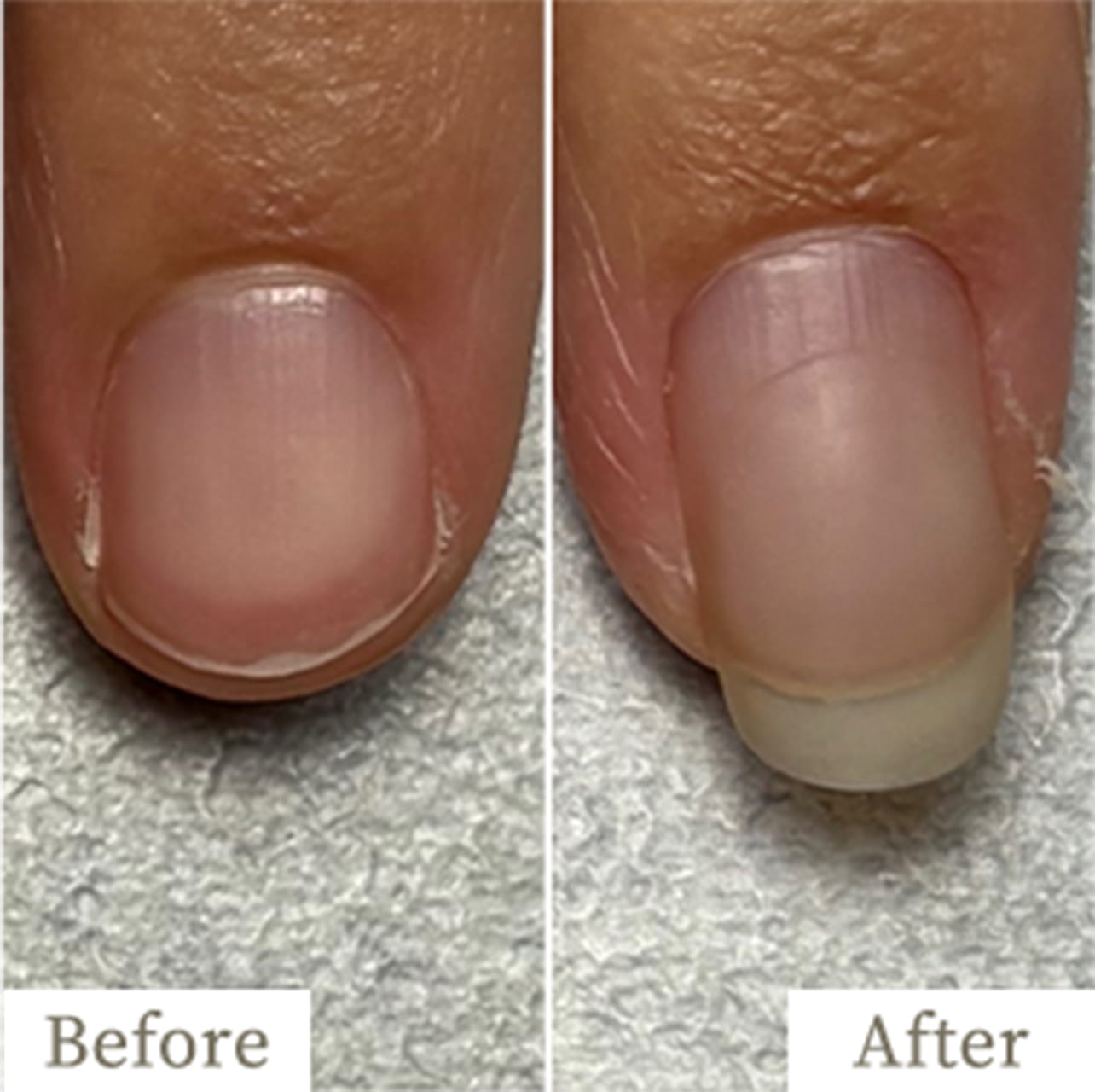 ba-img36 - トレフル|明石の深爪矯正ネイルサロン 明石市の深爪矯正専門サロン|深爪・噛み爪・むしり癖でお悩みならトレフル