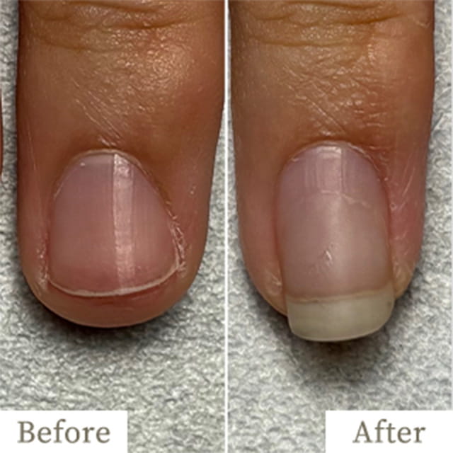 ba-img37 - トレフル|明石の深爪矯正ネイルサロン 明石市の深爪矯正専門サロン|深爪・噛み爪・むしり癖でお悩みならトレフル