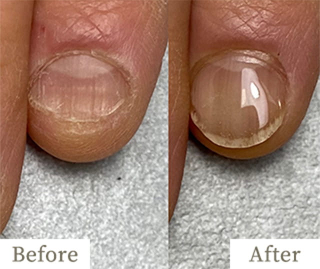 copy3-img - トレフル|明石の深爪矯正ネイルサロン 明石市の深爪矯正専門サロン|深爪・噛み爪・むしり癖でお悩みならトレフル