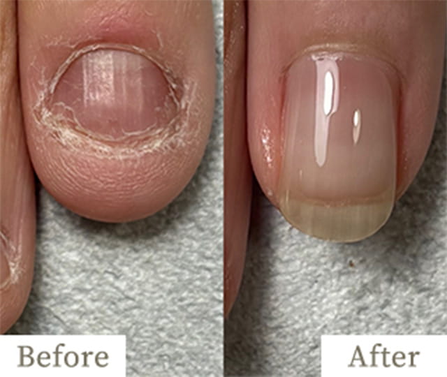 copy4-img - トレフル|明石の深爪矯正ネイルサロン 明石市の深爪矯正専門サロン|深爪・噛み爪・むしり癖でお悩みならトレフル