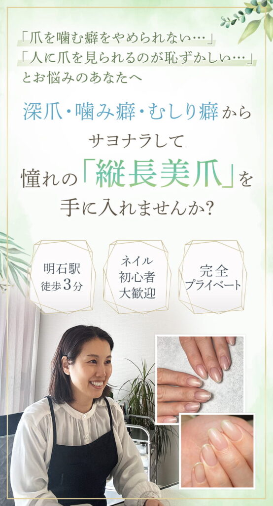 mv-sp - トレフル|明石の深爪矯正ネイルサロン 明石市の深爪矯正専門サロン|深爪・噛み爪・むしり癖でお悩みならトレフル