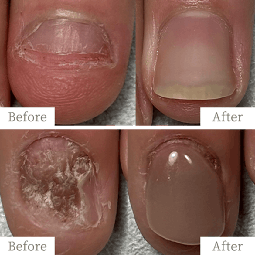 recruit-img5 - トレフル|明石の深爪矯正ネイルサロン 明石市の深爪矯正専門サロン|深爪・噛み爪・むしり癖でお悩みならトレフル