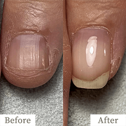 review-03-img3 - トレフル|明石の深爪矯正ネイルサロン 明石市の深爪矯正専門サロン|深爪・噛み爪・むしり癖でお悩みならトレフル